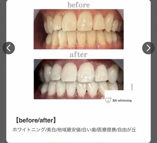 エミルカ　自由が丘店所属・ニキビ改善ハーブ🌿 ハナシマのその他イメージ