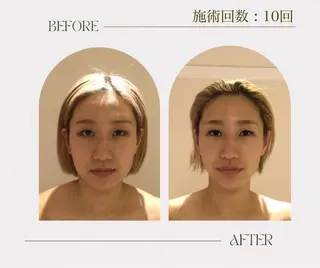 韓国式小顔コルギ BE-CUTE北参道のエステ・リラクイメージ