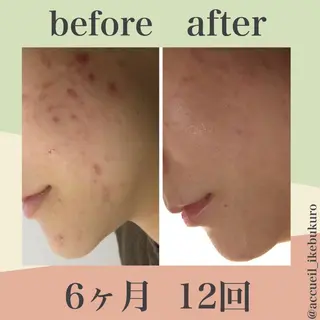 ショート カラー パーマ ヘアアレンジ メンズ キッズ ネイル マツエク・マツパ ニキビ・肌質改善専門 ♡人生が変わるサロンのエステ・リラクイメージ