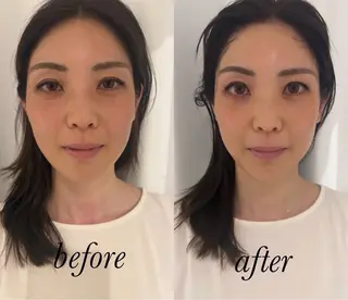 鍼灸サロン mahorobaトモのエステ・リラクイメージ