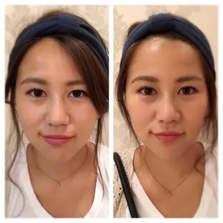 美容鍼サロン    Fleurir所属・伊藤 かなえのエステ・リラクイメージ