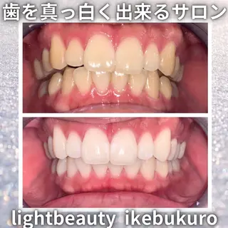 ライトビューティー 池袋店のその他イメージ