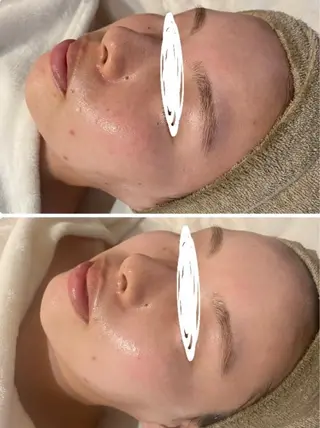 中目黒ハーブピーリン グ🌿ララピールのエステ・リラクイメージ