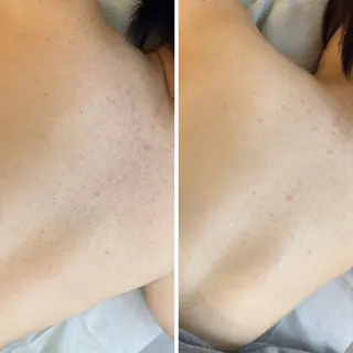 うなじ脱毛/美肌脱毛 LABELのエステ・リラクイメージ