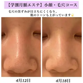 Bellesthe （ベルエステ）のエステ・リラクイメージ