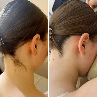 うなじ脱毛/美肌脱毛 LABELのエステ・リラクイメージ