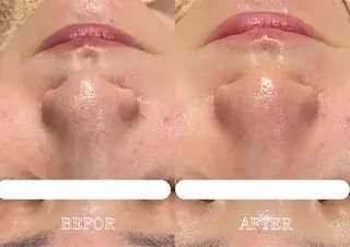 Lys Blancのエステ・リラクイメージ