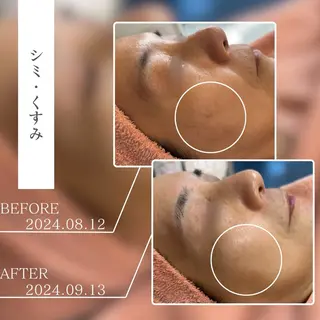 キッズ BestBelleꕤ 大阪福島/肌質改善のエステ・リラクイメージ