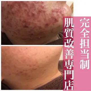 ミディアム カラー パーマ ヘアアレンジ メンズ ネイル マツエク・マツパ アイブロウ ニキビ・肌質改善専門 ♡人生が変わるサロンのエステ・リラクイメージ