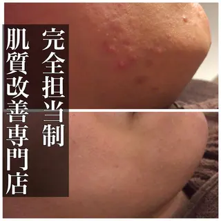 ミディアム カラー パーマ ヘアアレンジ メンズ キッズ ネイル マツエク・マツパ ニキビ・肌質改善専門 ♡人生が変わるサロンのエステ・リラクイメージ