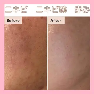 エステサロン　Sブランペタル所属・三沢市エステサロン Sブランペタルのエステ・リラクイメージ