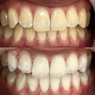 LBSホワイトニング 銀座店💎スタッフ峯のその他イメージ