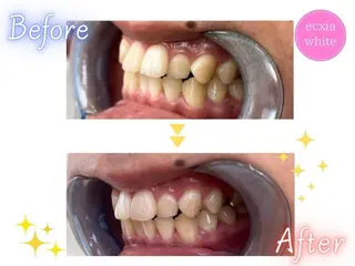 セルフホワイトニング エクシア五反田店のその他イメージ