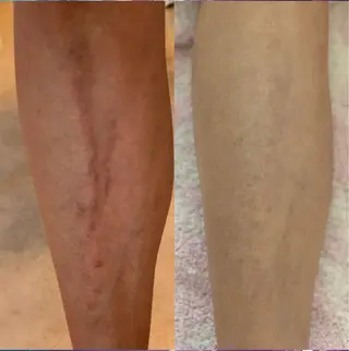 Blooming所属・LOUISE. ／肌質・頭皮のエステ・リラクイメージ