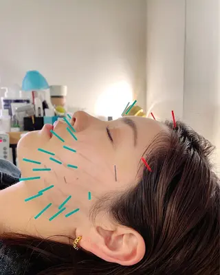 小顔美容鍼専門サロン 渋谷YZのエステ・リラクイメージ