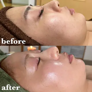 メンズ 【肌質改善サロン】 リーフィアのエステ・リラクイメージ