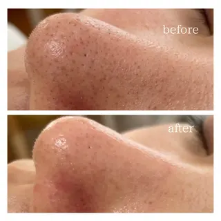 サロンピュア 所沢店のエステ・リラクイメージ