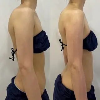 ブライダル痩身×脱毛 尼崎駅前サロンのエステ・リラクイメージ