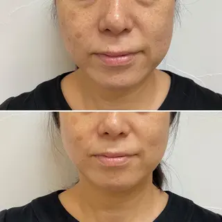 amy amie salon所属・amy amie 上村のマツエク・マツパデザイン