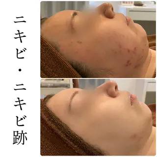 ハーブピーリング専門 BIOEL横浜のエステ・リラクイメージ