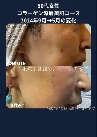 谷九上本町REINE YUKIのエステ・リラクイメージ