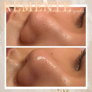 CHARMER韓国式美肌サロン所属・CHARMER🌹 Naokoのマツエク・マツパデザイン