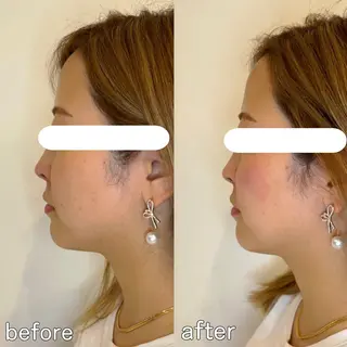 小顔矯正&美容整体 整え屋REDオーナーのエステ・リラクイメージ