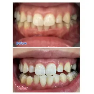 M渋谷店所属・Ｍ渋谷 ホワイトニングのエステ・リラクイメージ