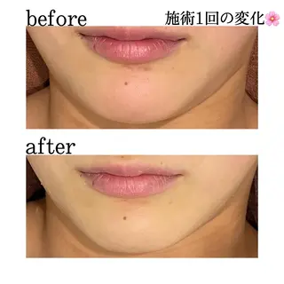 触れたくなる モテ肌へ...❤︎のエステ・リラクイメージ