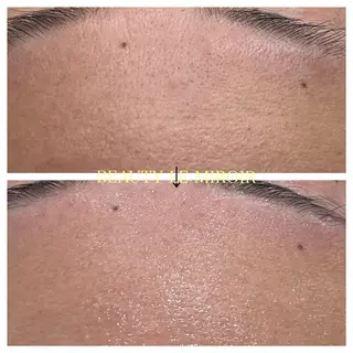 ビューティー ミロワールのエステ・リラクイメージ