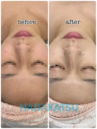 総合エステサロン 肌活のエステ・リラクイメージ