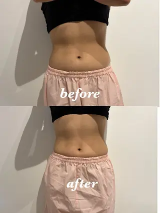 メンズ 腸活サポート みなみののエステ・リラクイメージ