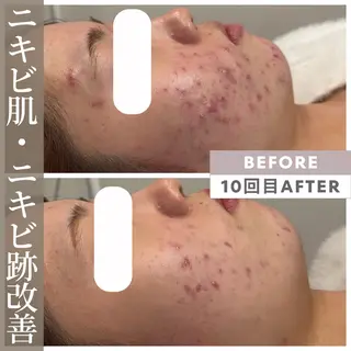 小顔矯正専門店 【RED】池田のエステ・リラクイメージ