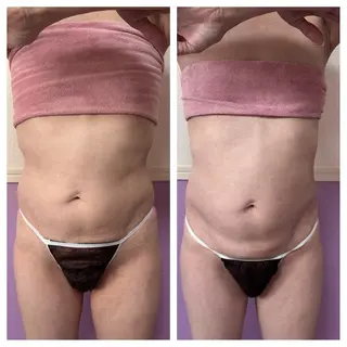 Miel所属・バストアップサロン Mielのエステ・リラクイメージ