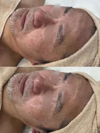 MAILE-マイレ-BEAUTY SALON所属・MAILE-マイレ- NARUMIのエステ・リラクイメージ