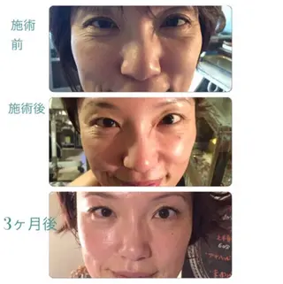 小顔バランス unicaのエステ・リラクイメージ