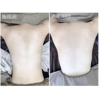 毛穴/毛穴洗浄専門 エミルカ船橋のエステ・リラクイメージ