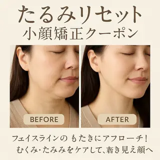 小顔矯正サロンAST【アスト】所属・小顔矯正サロン AST【アスト】のその他イメージ