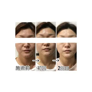 EARTH Coiffure beaute'新潟中野山所属・小池 怜香のエステ・リラクイメージ