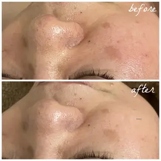 メンズ メナード岐阜茜部 杉浦のエステ・リラクイメージ