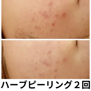 フェイシャル専門サロ ン　ERINのエステ・リラクイメージ