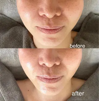 Lavi&所属・肌質改善サロン Lavi&のその他イメージ