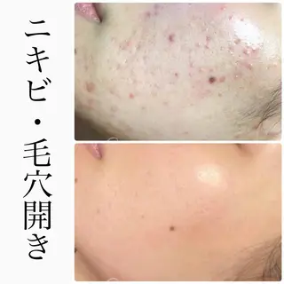 ハーブピーリング専門 BIOEL横浜のエステ・リラクイメージ