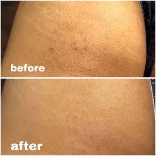 ハーブピーリング re:proのエステ・リラクイメージ