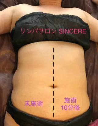 SINCERE MIYUKIのエステ・リラクイメージ