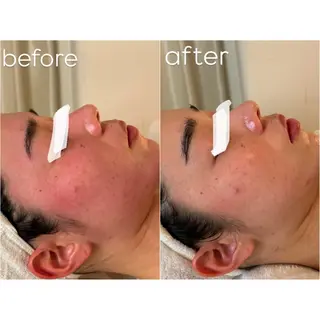 For...天王寺店 リンパ|ヘッドよもぎのエステ・リラクイメージ