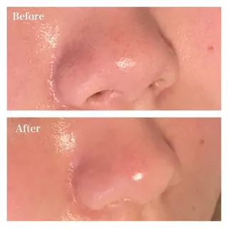 Ｂ&H所属・頭痛•肩こり専門/ 眉サロンB&H心斎橋のエステ・リラクイメージ