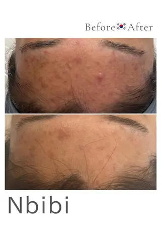 韓国🇰🇷価格 サロン_Nbibiのエステ・リラクイメージ