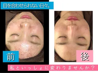 ロング カラー パーマ ヘアアレンジ メンズ ネイル マツエク・マツパ 四つ星サロン🎖 腸＆ニキビケアに特化のエステ・リラクイメージ