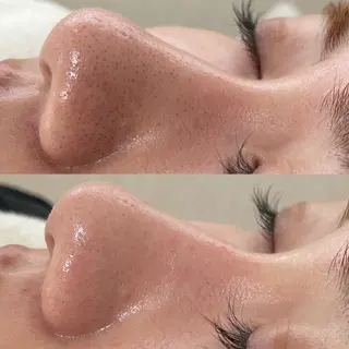 Eve [nail ＊wax＊HBL]のエステ・リラクイメージ